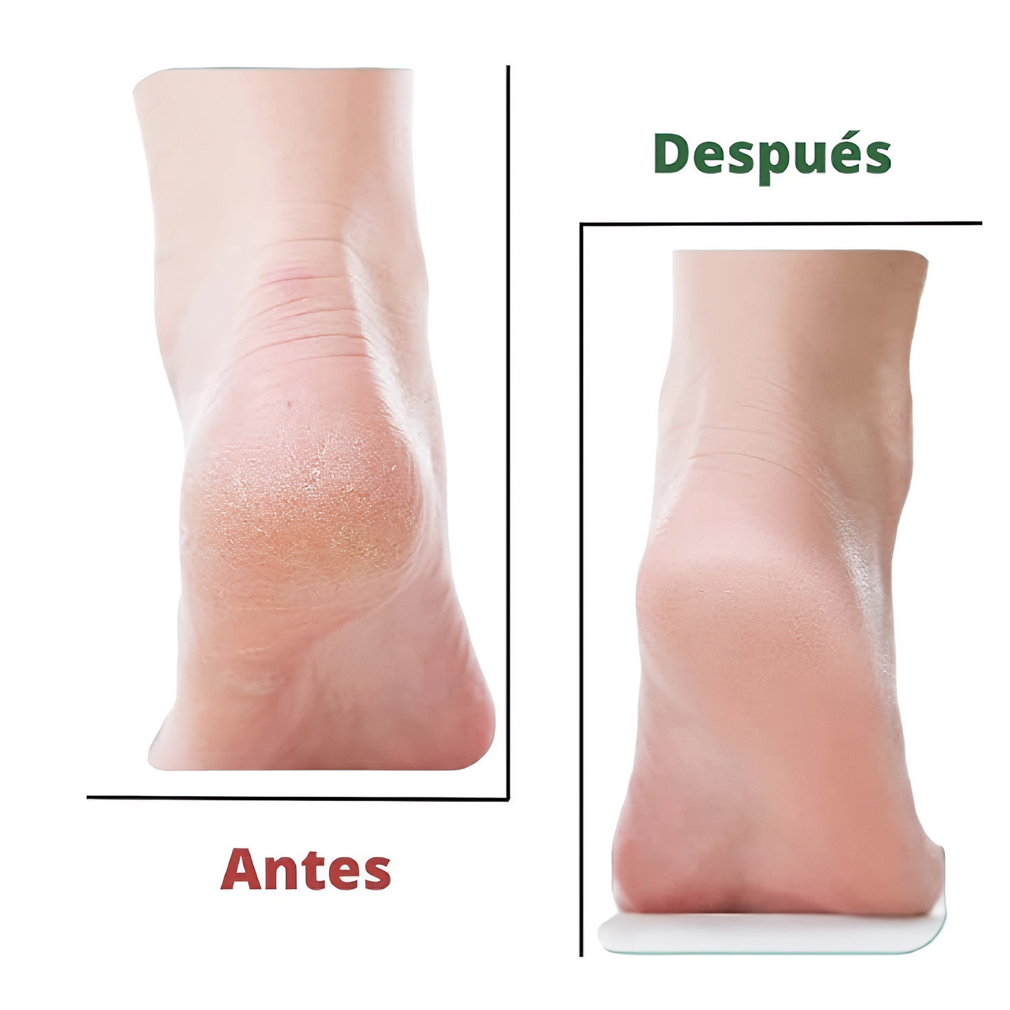 Exfoliante Natural para Pies